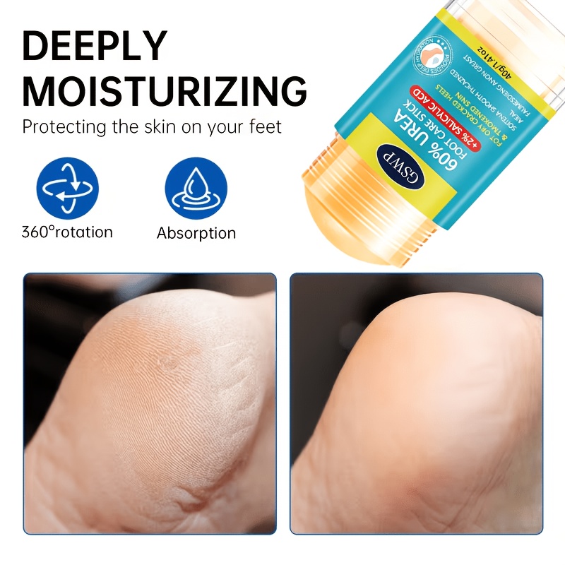 Stick de soin des pieds GSWP à - Urea Foot Cream avis et prix