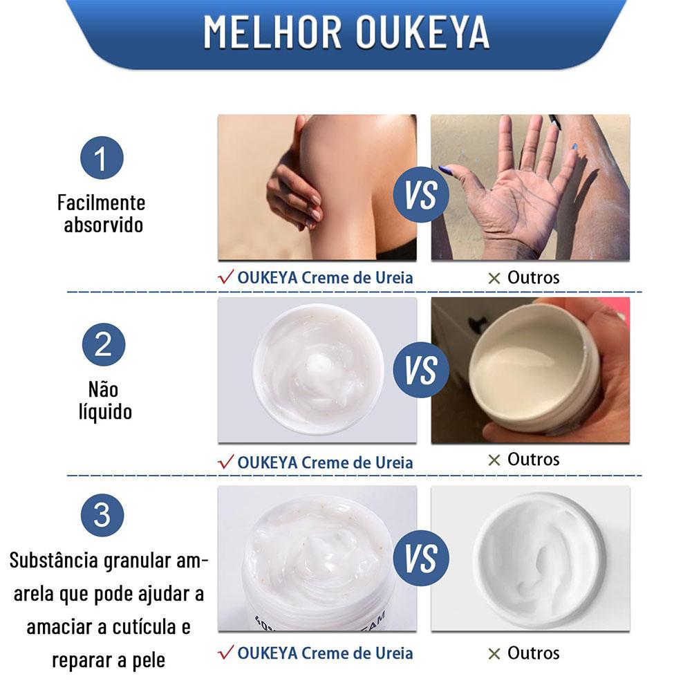 Crème à l'urée 40% hydratante  - Urea Foot Cream avis et prix